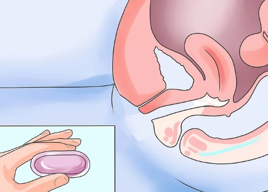 aplicación óvulos sequedad vaginal